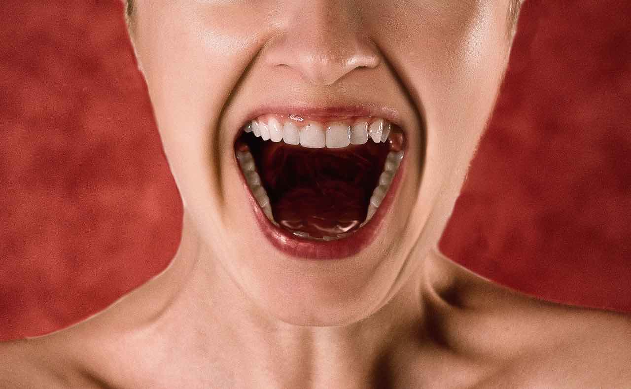 Denti macchiati